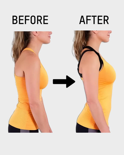 Cross-Back Front Closure Bra